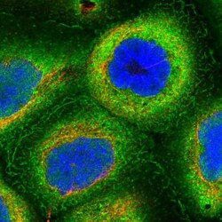 HN1L Antibody, Novus Biologicals:Antibodies:Primary Antibodies